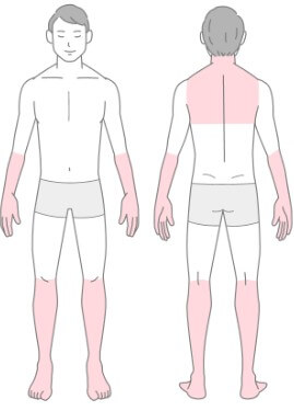 プレミアムクリニック全身脱毛範囲