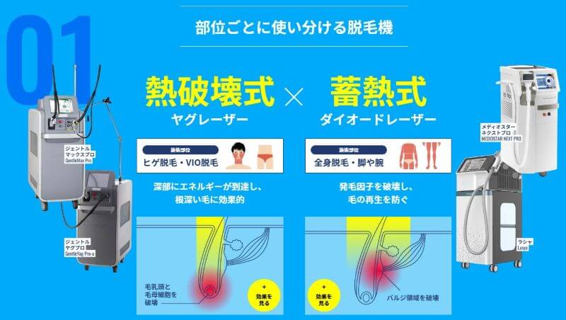 メンズリゼのヒゲVIOはジェントルマックスプロ