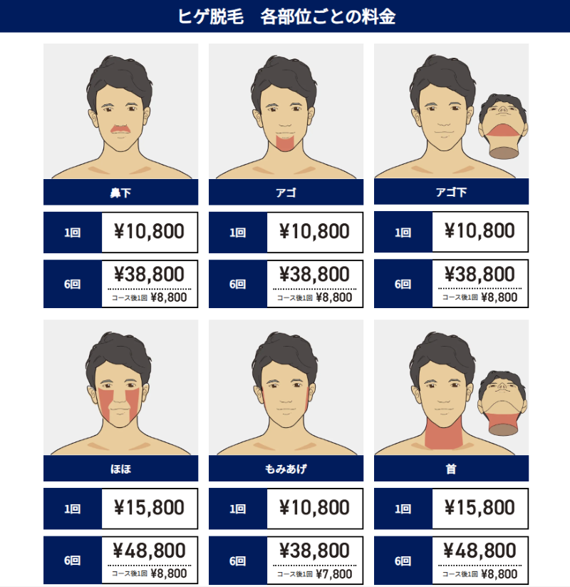 ゴリラクリニックヒゲ部位ごと