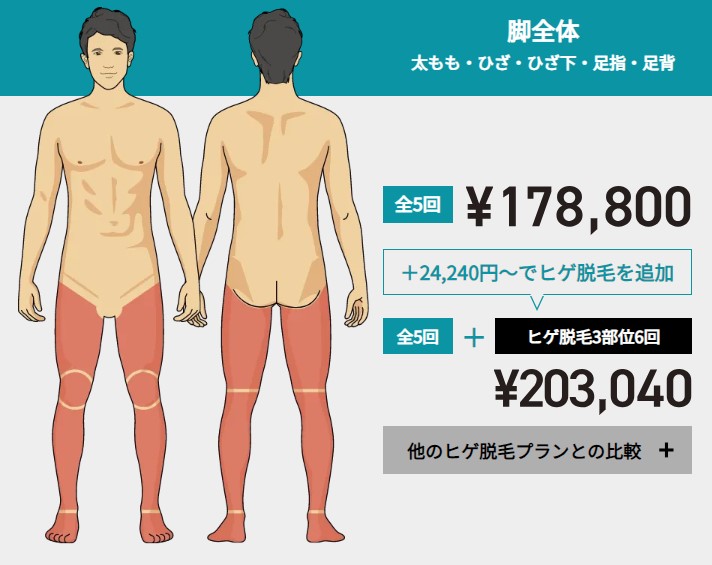 ゴリラクリニック脚全体脱毛