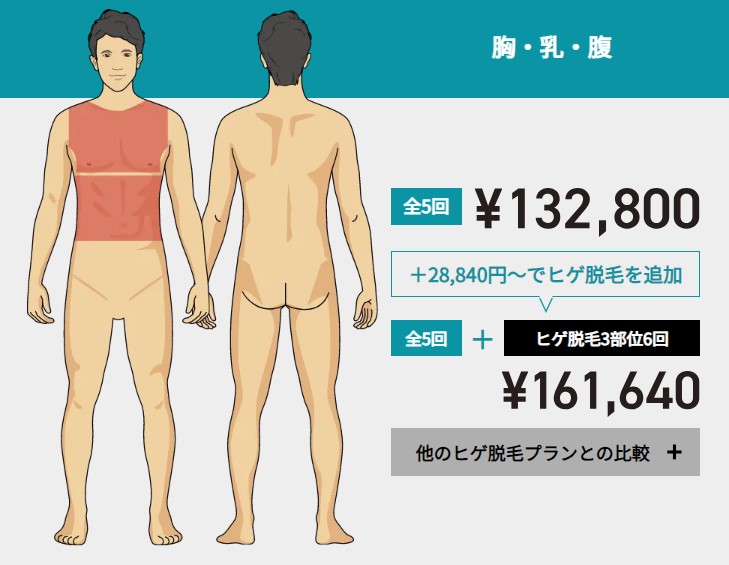 ゴリラクリニック胸乳腹脱毛