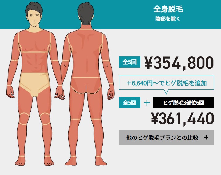 ゴリラクリニック全身脱毛（VIO除く）