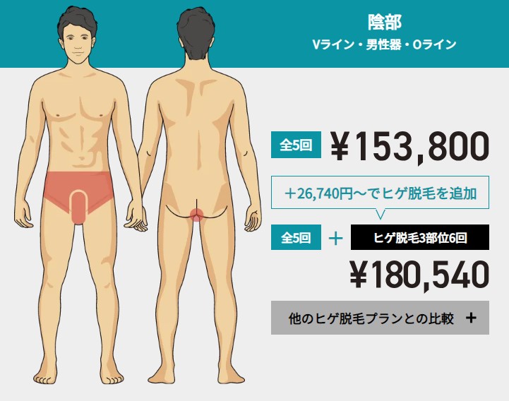 ゴリラクリニックVIO脱毛