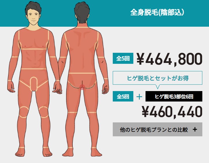 ゴリラクリニック全身脱毛（VIO込）