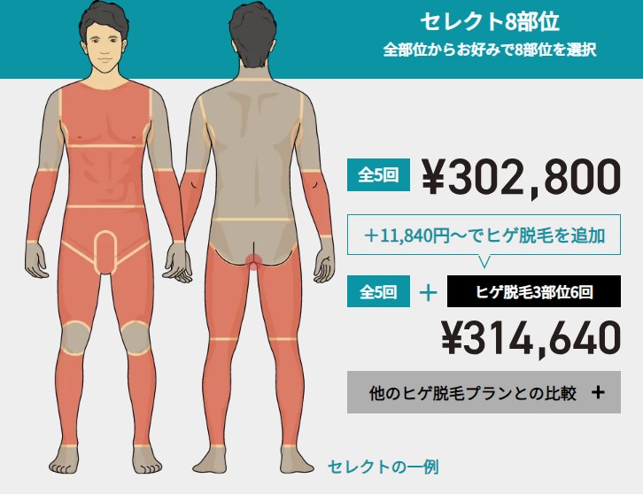 ゴリラクリニック全身脱毛セレクト８部位