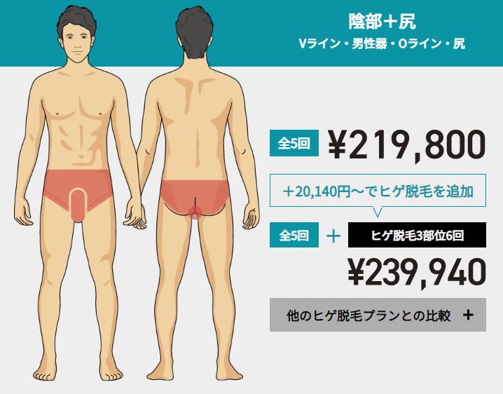 ゴリラクリニックVIO＋尻脱毛