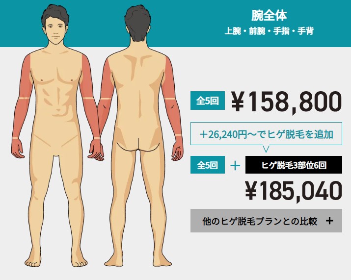 ゴリラクリニック腕全体脱毛
