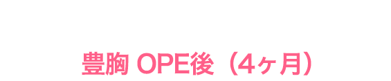 豊胸OPE後4ヶ月