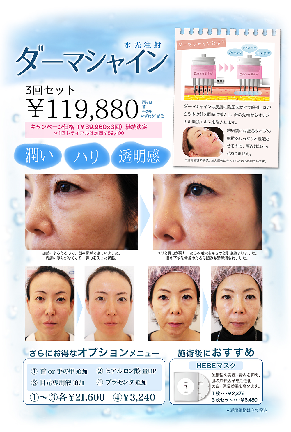 dermashine march 2017