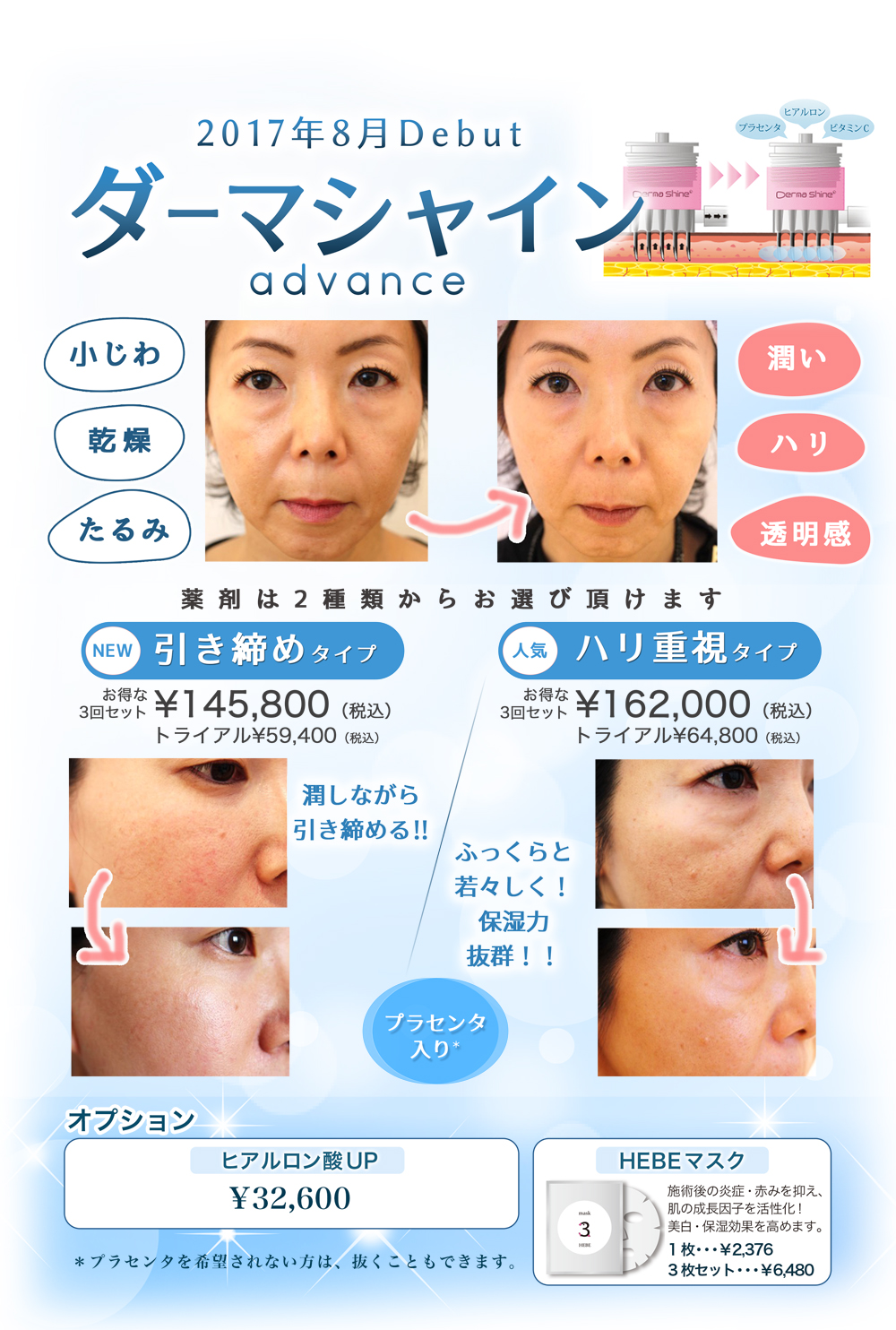 dermashine march 2017