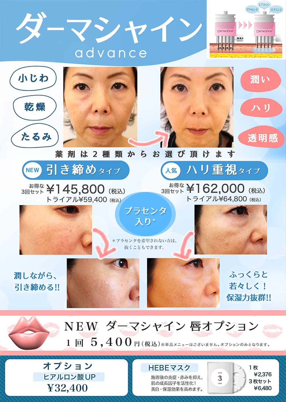 dermashine march 2017
