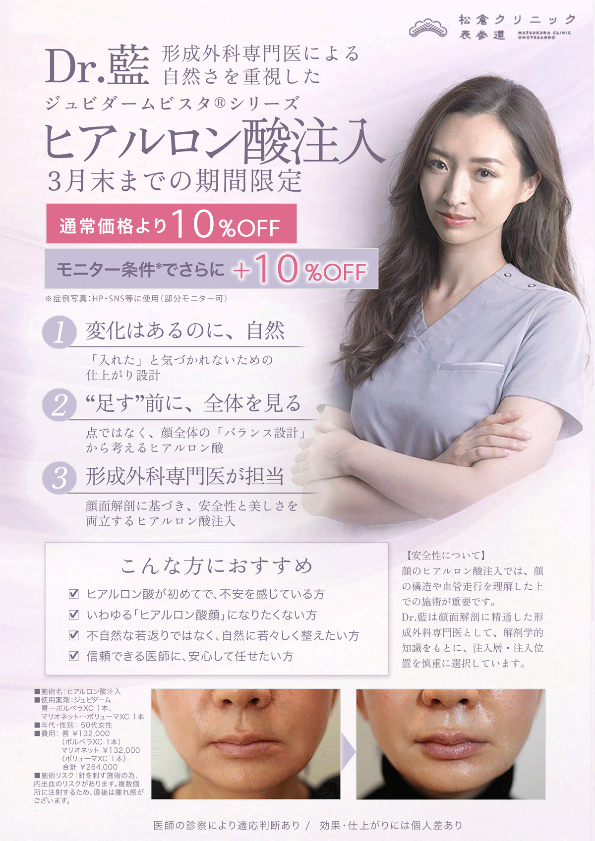 Dr.藍によるジュビダームビスタ®シリーズ（アラガン社製ヒアルロン酸）注入 期間限定オファー