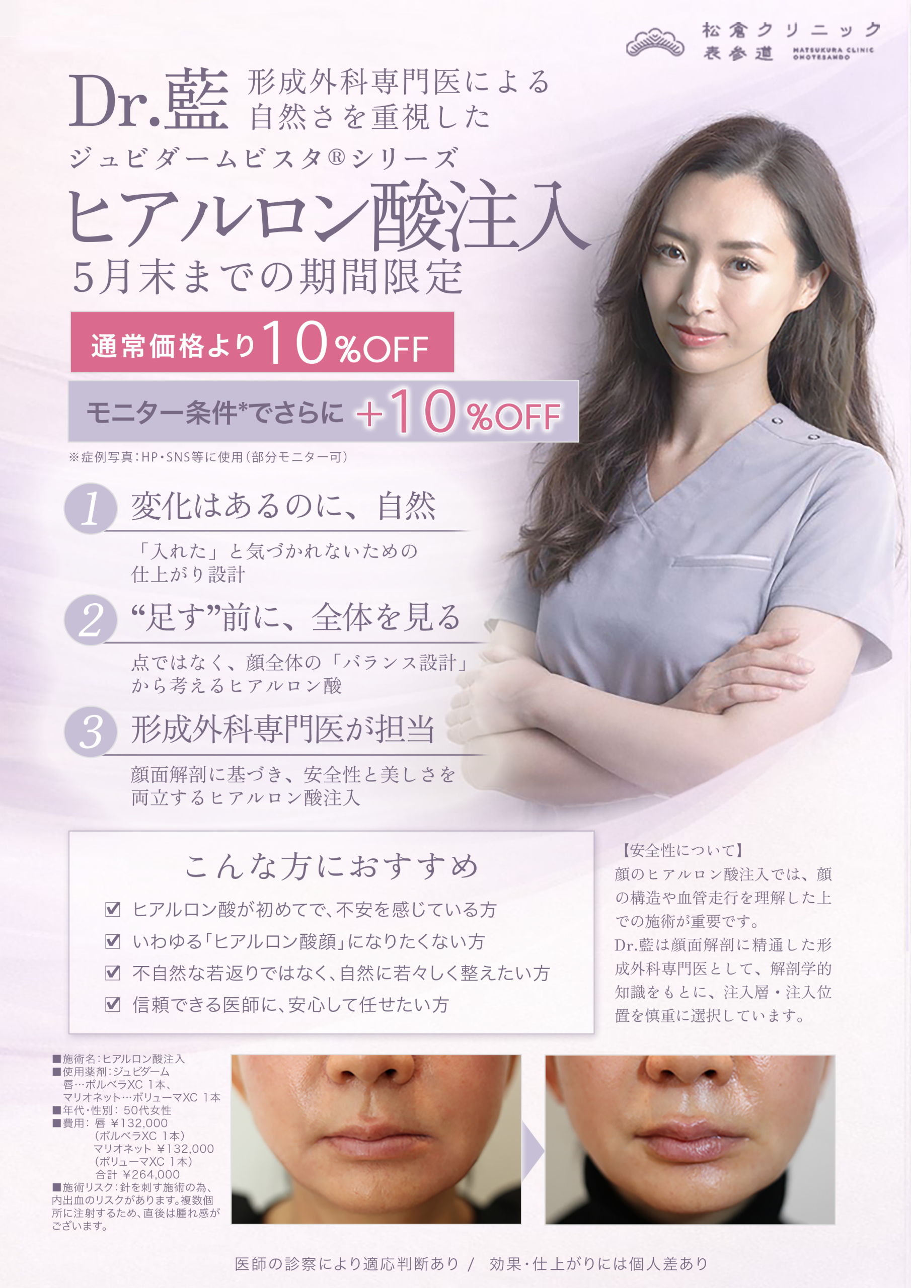 Dr.藍によるジュビダームビスタ®シリーズ（アラガン社製ヒアルロン酸）注入 期間限定オファー