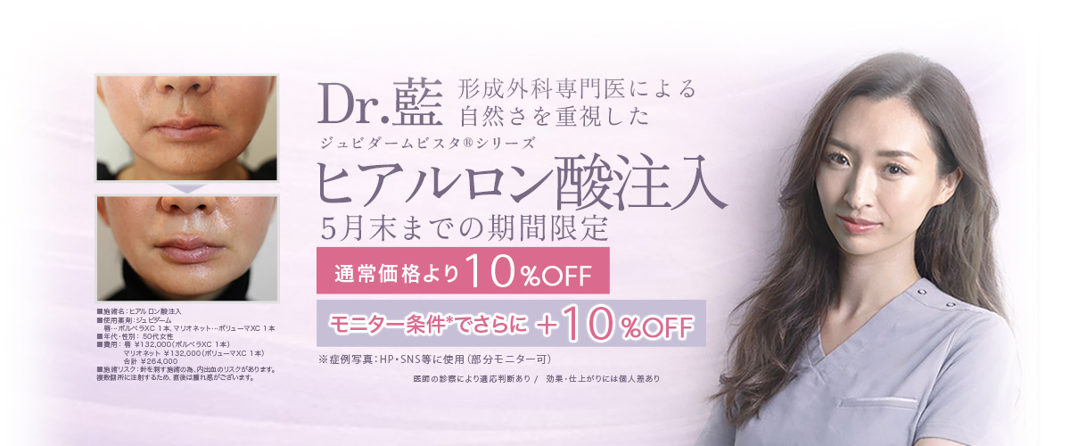 Dr.藍によるヒアルロン酸注入　5月末までの期間限定　通常価格より 10％OFF　モニター条件で さらに＋10％OFF