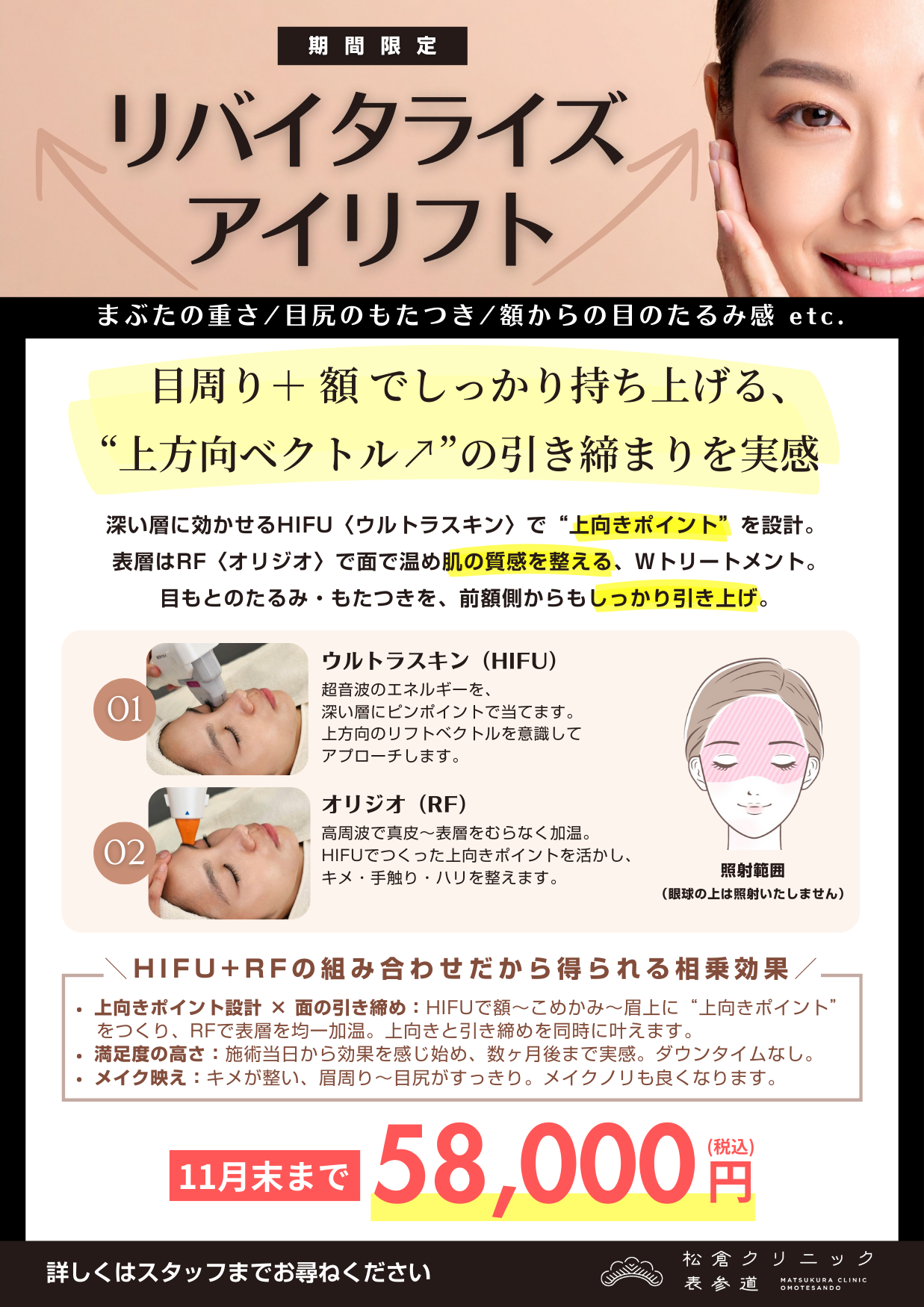 リバイタライズアイリフト（期間限定コース）