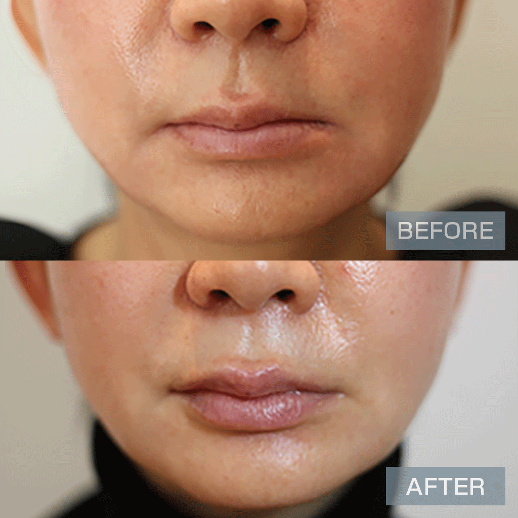 No.12937の症例写真